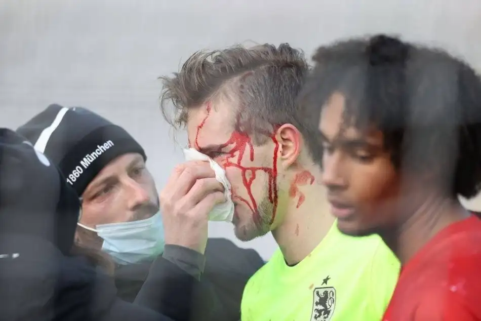 Joshua Zirkzee Münih derbisinde kırmızı kart gördü